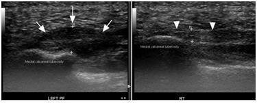 Traditioneel onkruid Clip vlinder Wat kunnen we zien met echografie? Fysiotherapie Hoorn