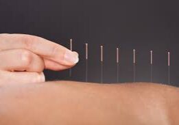 dry needling